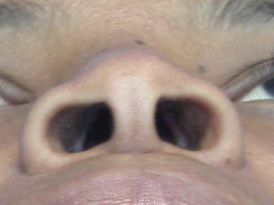 nostril.jpg
